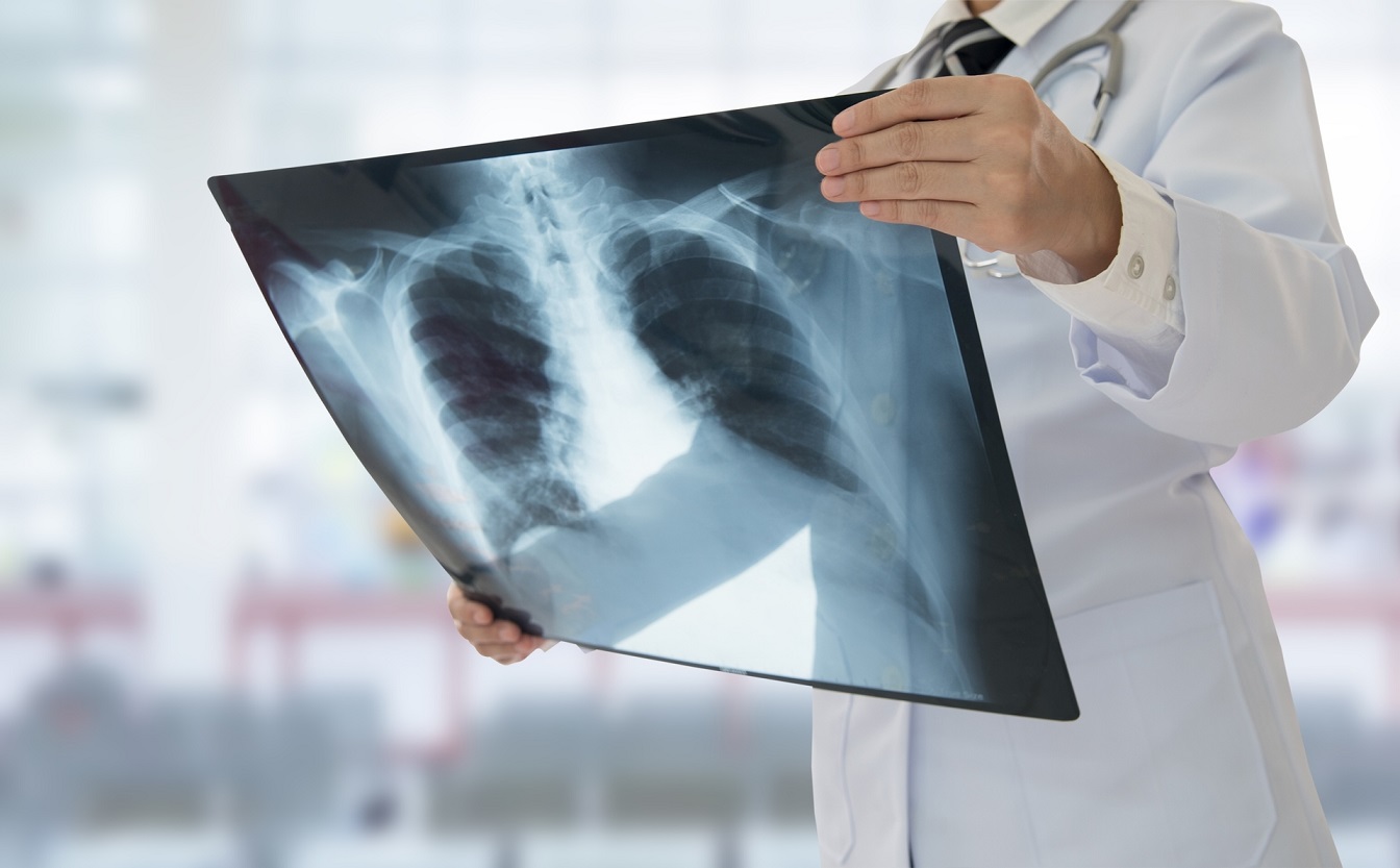 Comment se déroule une radiographie ?